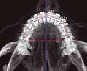 processo do diagnóstico e planeamento tridimensional através de uma Análise Facial e do Protocolo SYM ; Definir diagramas