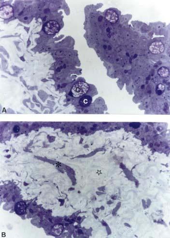 Figura 23-Papila urogenital de macho de C.
