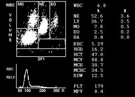 ÍNDICES HEMATIMÉTRICOS VOLUME CORPUSCULAR MÉDIO: VCM VOLUME GLOBULAR MÉDIO: VGM Como determinar?