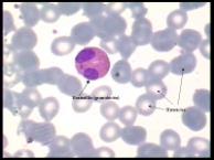 500 (45-75%) 22-40% Basófilos 0-200 (0-2%) 0-2% Eosinófilos 40-500 (1-5%) 1-5% Linfócitos 880-4.000 (22-40%) 45-75% Monócitos 120-1.