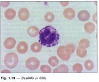 EOSINÓFILOS EOSINOFILIA: Asma; Processos alérgicos; Parasitoses; Leucemias mielóides crônicas; Infecções bacterianas com bom prognóstico; EOSINOPENIA: Corticóides; Infecções bacterianas com mau