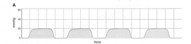 Avalie a qualidade da RCP ETCO2 < 10mmHg = deve-se melhorar as compressões ETCO2 < 10 mmhg após 20 min de RCP com paciente intubado = baixa probabilidade de ressuscitação ETCO2 = CO2 ao final da