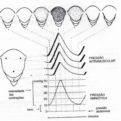 Membranas amnióticas ou bolsa