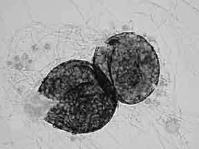 contaminante Pode se parecer com Histoplasma, mas sem microconídios e não é dimórfico Macroconídios grandes, esféricos