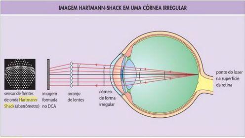 Etapa 0 - Aquisição de imagens Imagens obtidas utilizando sensor de Hartmann-Shack Cada imagem está associada