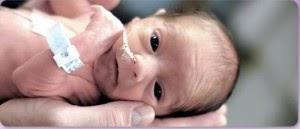 Características Clínicas O aspecto geral do bebê PIG varia de normal, pelo menos à primeira vista, As suturas do crânio podem ser amplas, devido a uma falha no crescimento ósseo.