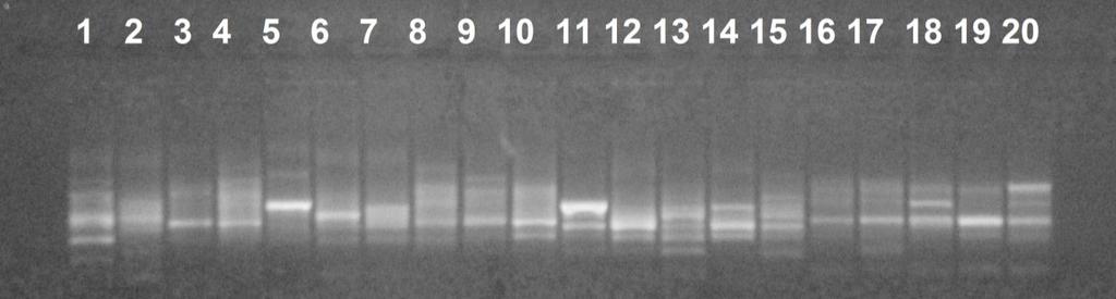O perfil eletroforético (Figura 1) representa os DNAs extraídos, indicando que a extração foi bem sucedida e que os mesmos estão de boa qualidade. na Tabela 2.