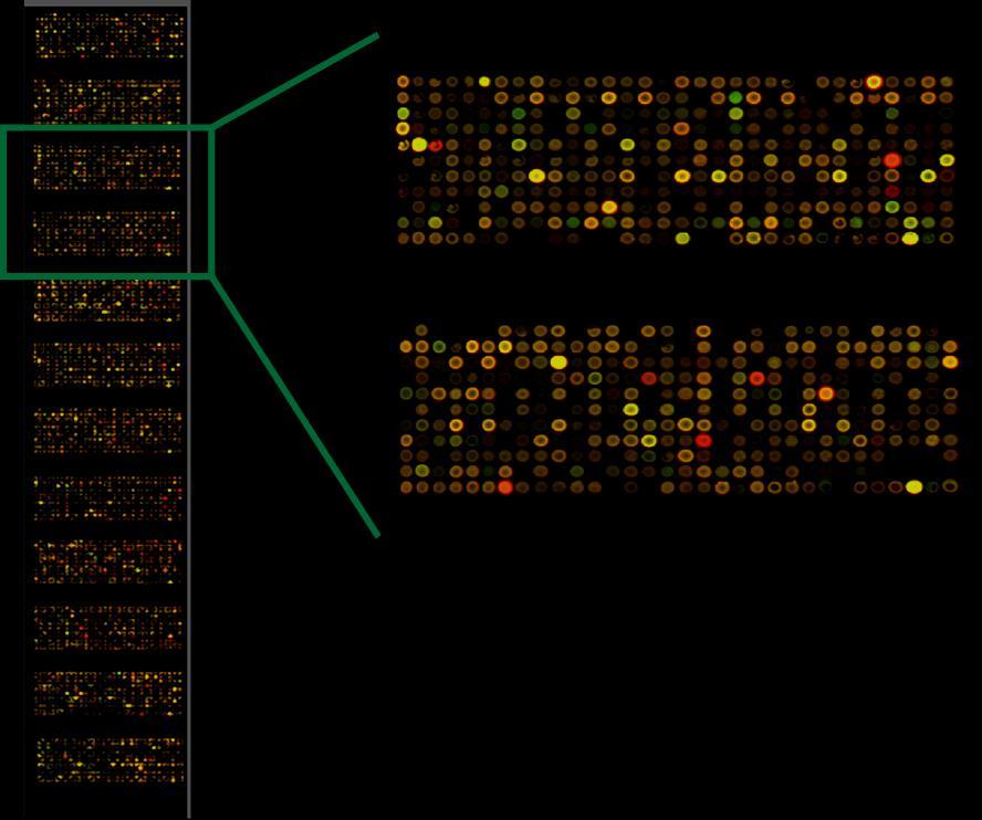 Microarray Imagem de um microarray