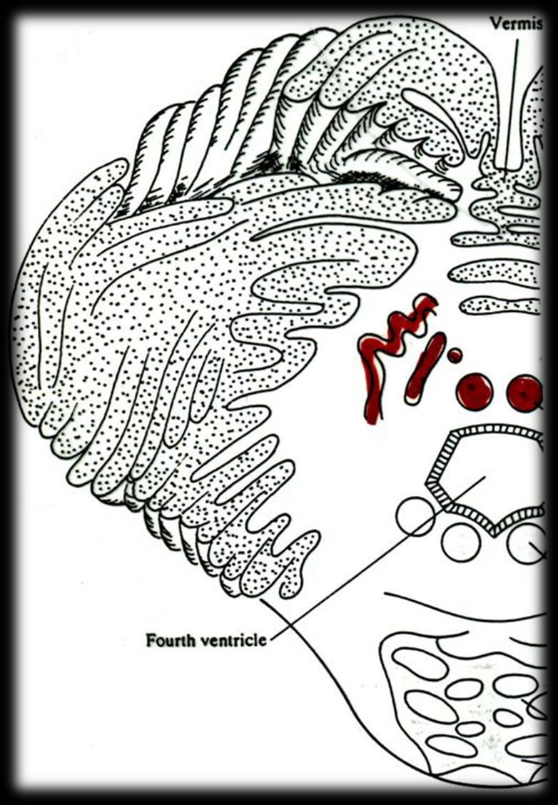 Neuroblastos Alares (partes dorsais) Córtex