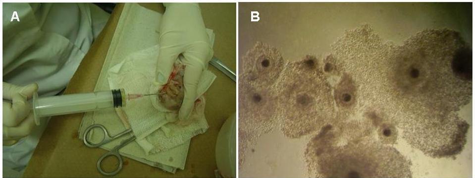 Coleta de Oócitos in vitro Aspiração Folicular Aspiração do