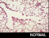 FISIOPATOLOGIA VENTILAÇÃO MECÂNICA INFECÇÃO DESNUTRIÇÃO Vit.