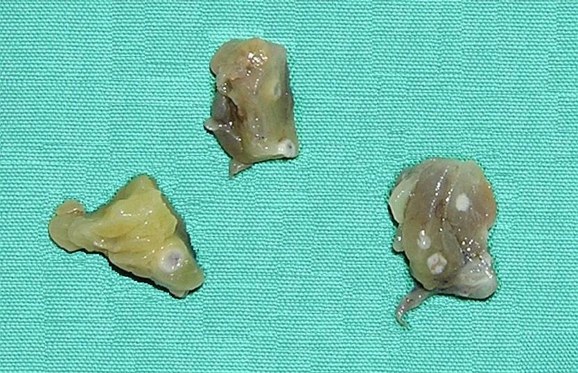 Figura 2 Linfonodos destacados como pequenos nódulos brancos na gordura pericólica após processo de clareamento.
