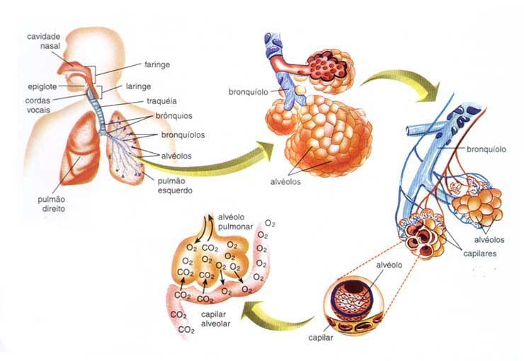 O enfisema pulmonar é definido anatomicamente como aumento dos espaços aéreos distais ao bronquíolo terminal, com destruição das paredes alveolares.