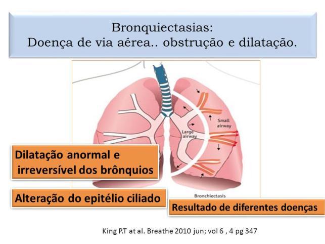 e os capilares alveolares apresentam-se destruídos; a lesão pulmonar é em geral permanente. Trata-se da DPOC mais comum.