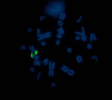 a) b) Figura 23: Cromossomos mitóticos de
