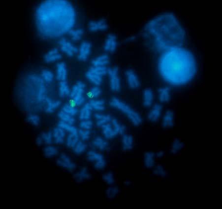 a) b) Figura 25: Cromossomos mitóticos de Moenkhausia