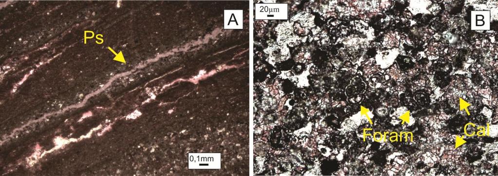 interligações entre os mesmo, atingindo diâmetros entre 2 mm a 1,5 cm.