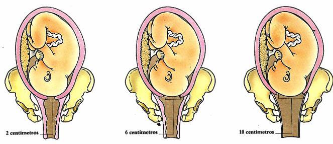 No seu estado normal, o colo do útero é um tubo de parede espessa, com cerca de dois centímetros de comprimento e seguramente fechado.