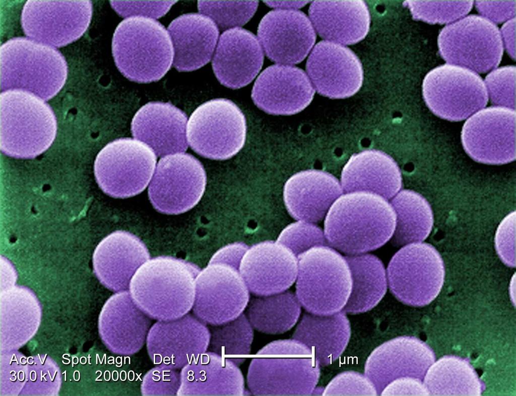 40 Figura 5: Serratia marcescens Fonte: Comons, 2010. 5.5 Fungos do solo Os fungos podem ser classificados na Divisão Chytridiomycota, Zygomycota, Ascomycota, Basiomycota e Deuteromycota.