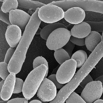 43 Figura 6: Candida albicans Fonte: Curiosidades de microbiologia, 2010. 5.