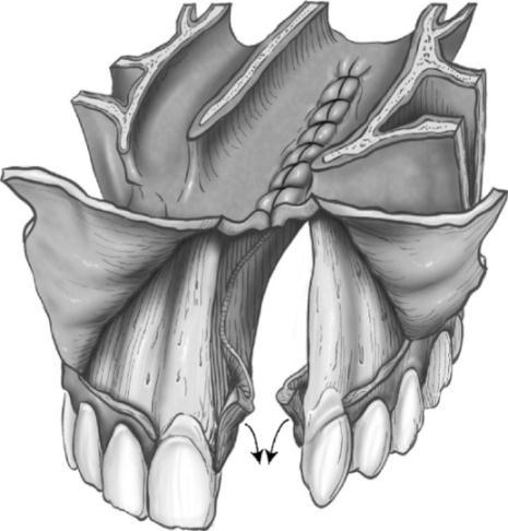 O paciente foi posicionado em decúbito dorsal com coxim na região glútea para evidenciar a espinha e crista ilíaca ântero-superior.
