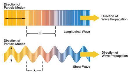 ELASTOGRAFIA HEPÁTICA E ONDAS