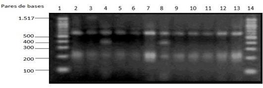 No tratamento do gene 16S com a enzima AluI foi observado no mínimo 2 bandas e no máximo 5 (Figuras 19 e 20).