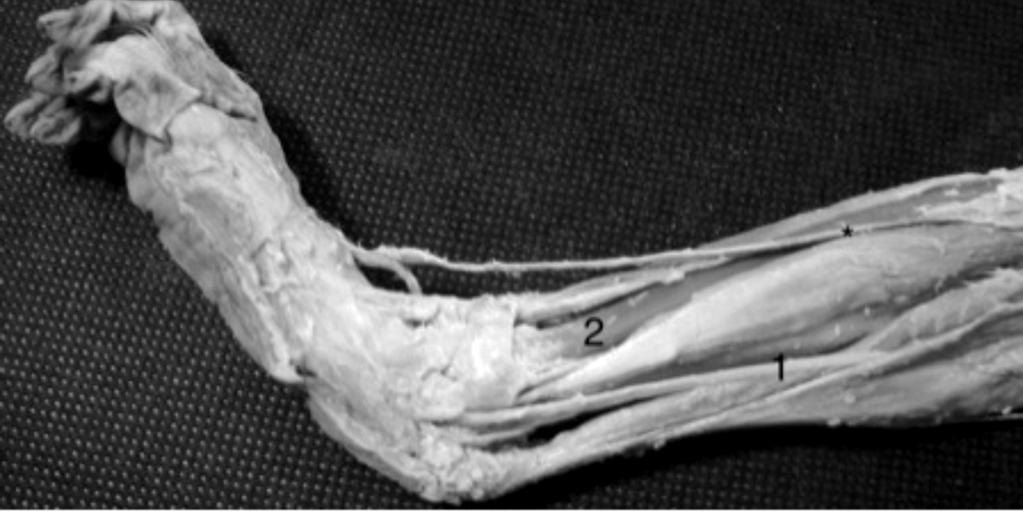 Comparative anatomical study of the leg s nerves of Cebus (barbed capuchins) with baboons, chimpanzees and modern humans 1 3 Fig.1. A view of medial aspect of the right leg of Cebus.