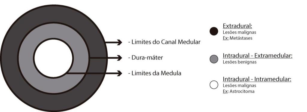 Figura 2. Espaços do canal medular.
