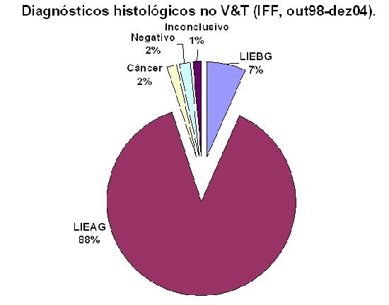 Citologia = HSIL, JEC visível e alterações maiores à colposcopia => Ver-e-tratar (S&T performed in HSIL and presence of major