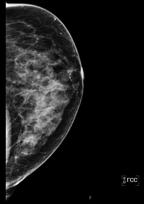 Ela realizou mamografia no dia 01/03/2018