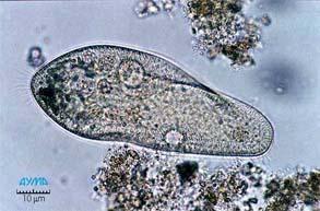 Ciliophora são protozoários que possuem CÍLIOS em volta do corpo.