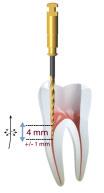 direto aos terços médio e apical; Reduz o risco de travamento e fratura dos instrumentos sucessivos.