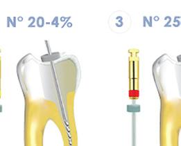 Extremamente flexíveis e resistentes Rápido Mais eficiente Técnica simples Melhor