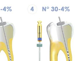 centro do canal endodontia PROTOCOLO DE USO 20 25 30 6% 21 mm 25 mm 4% 2% 21 mm 25