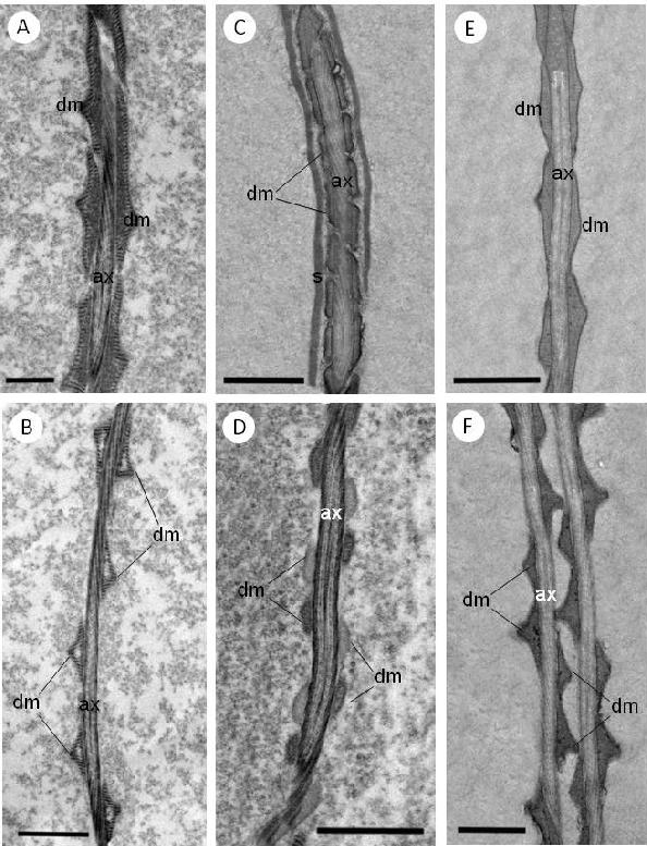 Figura 12. Micrografias Eletrônicas de Transmissão da região do flagelo em secções longitudinais. (A-F) Mostrando o axonema (ax) retorcido e envolvido pelos derivados mitocondriais (dm).