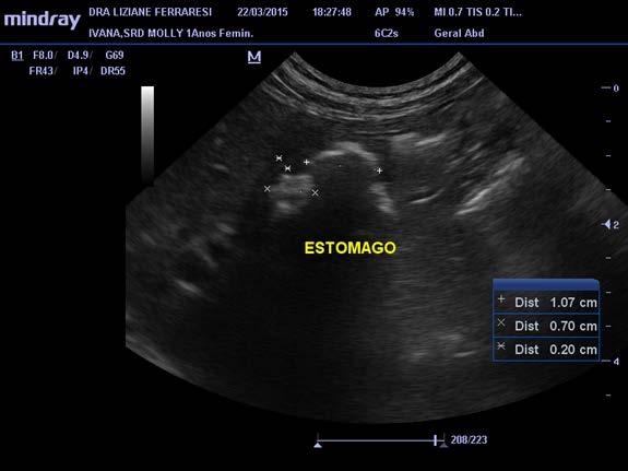 7 Figura 1. Imagem de ecografia abdominal evidenciando corpo estranho gástrico. Com diagnóstico de corpo estranho gástrico o animal foi submetido à cirurgia de gastrotomia.