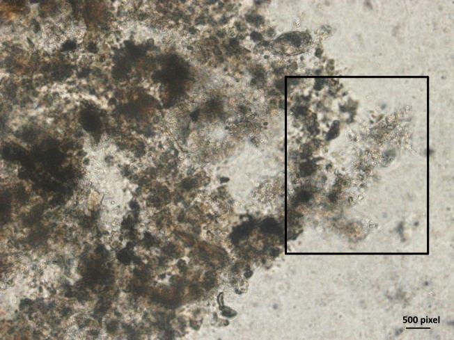 Com isso, os grânulos maiores presentes no lodo podem ter sido carreados para descarte e os grânulos encontrados referem-se a renovação da microbiota. Figura 5.