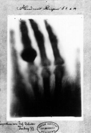 Produção de Raios X Os raios X foram descobertos em 1895 de forma quase acidental. O físico alemão Wilhelm Conrad Roentgen realizava experimentos com um tudo de vidro, onde foi feito vácuo.