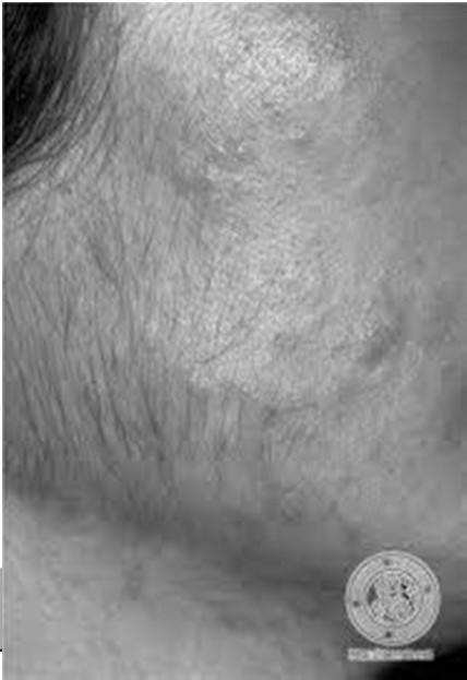 distribuição de pêlos Observar anormalidades como: edema, falta de