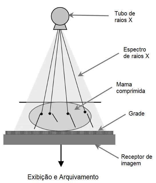 11 Figura 2.7 Processo típico de formação da imagem de raios X em mamografia. (Adaptado de Mahesh, 2004.