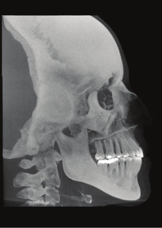 (A) Radiografia panorâmica.