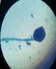esporos de reprodução se encontrarem nesse local-, em lâmina com uma gota do corante azul de metila (Figura 5), observando os resultados em microscópio
