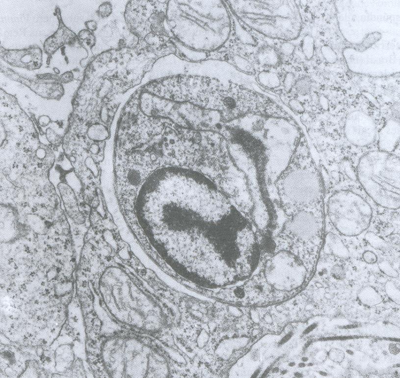 Amastigota Fagocitado por células do sistema mononuclear fagocítico: