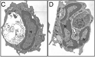 neutrófilos Neutrófilos em apoptose (horas) são fagocitados por macrófagos morta viva