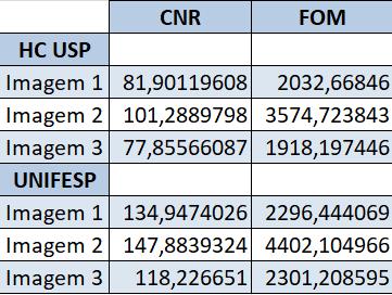 29 Tabela 7 Resultados CNR e FOM Ao analisar a Tabela 7, é possível notar que quanto maior o valor de CNR maior o valor da FOM.