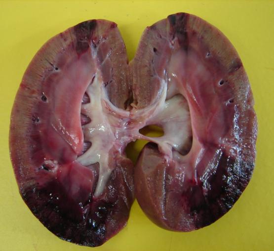 Órgãos compactos (rim, coração, baço) Hemorrágico Área isquêmica associada à
