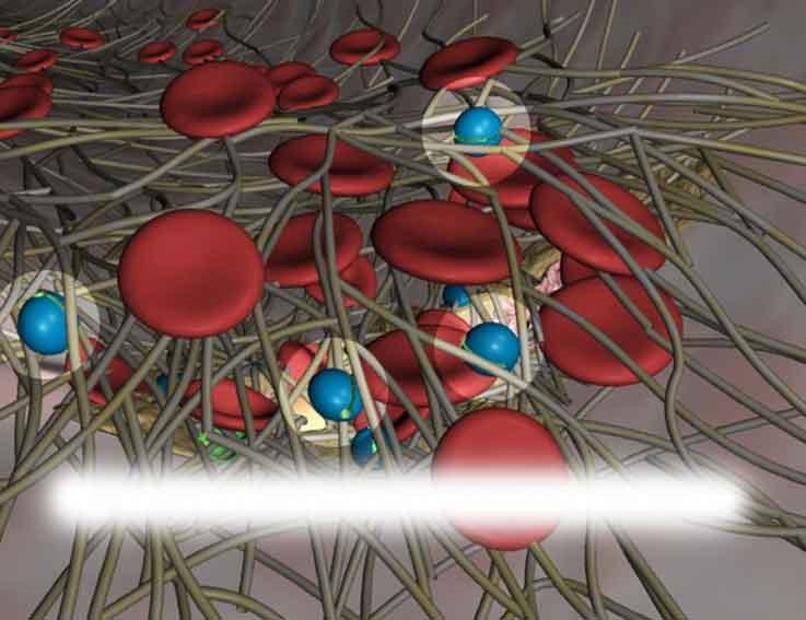 Vantagem: preservação das válvulas venosas e baixa incidência