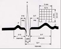O papel de registro eletrocardiográfico é quadriculado e dividido em quadrados pequenos e grandes. Interpretação: Sentido horizontal, tempo (segundo).