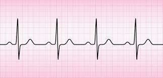 Cada registro eletrocardiográfico deve ser analisado sistematicamente, considerando-se: ritmo; frequência e